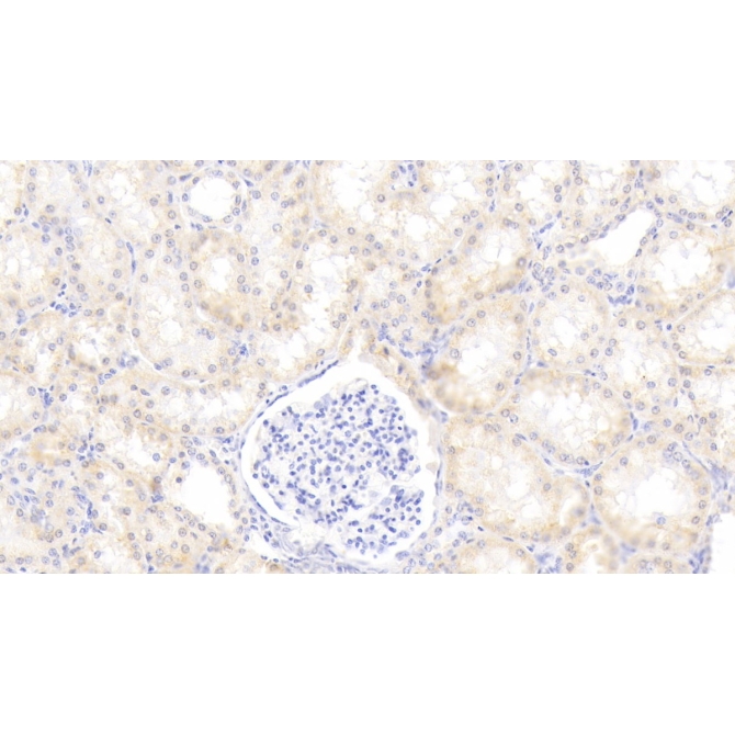 Alpha-1-Antitrypsin (a1AT) Human Monoclonal Antibody