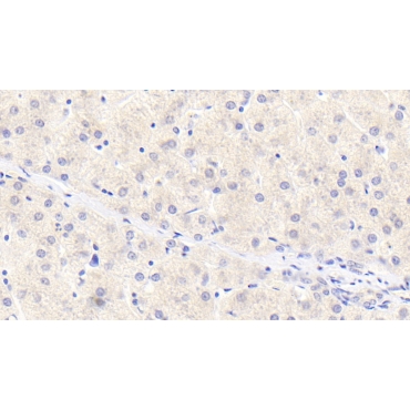 Alpha-1-Antitrypsin (a1AT) Human Monoclonal Antibody