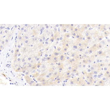 Alpha-1-Antitrypsin (a1AT) Human Monoclonal Antibody