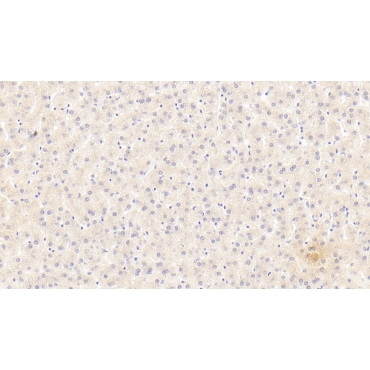 Alpha-1-Antitrypsin (a1AT) Human Monoclonal Antibody