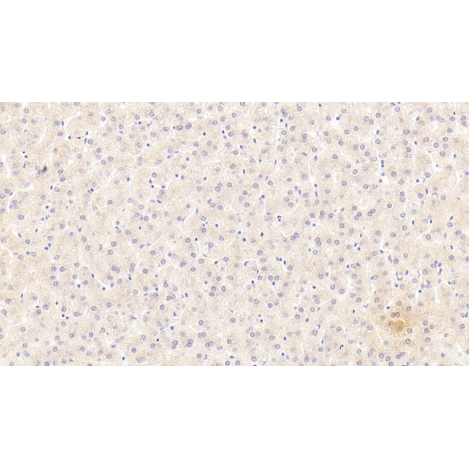 Alpha-1-Antitrypsin (a1AT) Human Monoclonal Antibody