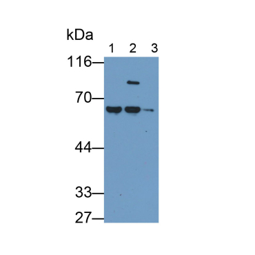 Alpha-1-Antitrypsin (a1AT) Human Monoclonal Antibody