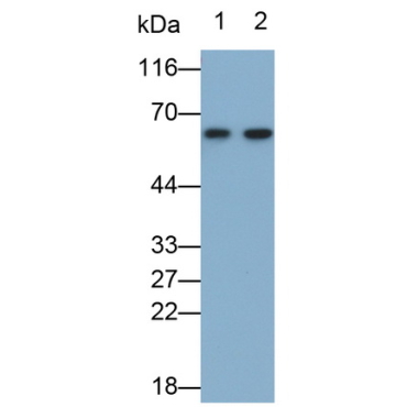 Alpha-1-Antitrypsin (a1AT) Human Monoclonal Antibody