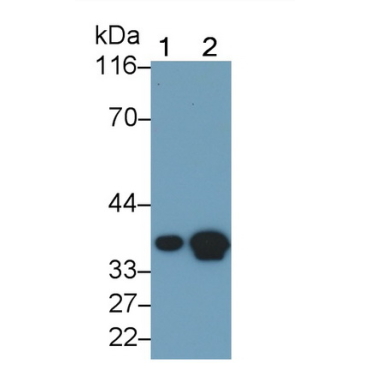 Lactate Dehydrogenase B (LDHB) Human Monoclonal Antibody