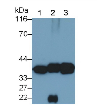 Lactate Dehydrogenase B (LDHB) Human Monoclonal Antibody