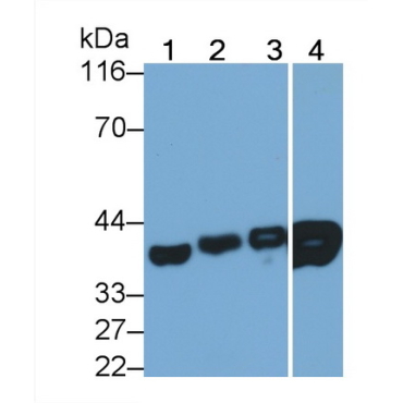 Lactate Dehydrogenase B (LDHB) Human Monoclonal Antibody