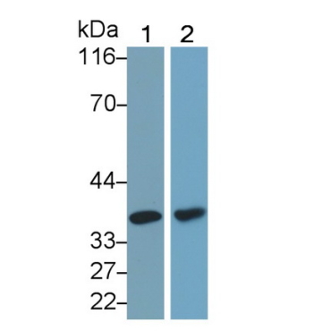Lactate Dehydrogenase B (LDHB) Human Monoclonal Antibody