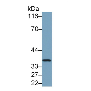 Lactate Dehydrogenase B (LDHB) Human Monoclonal Antibody
