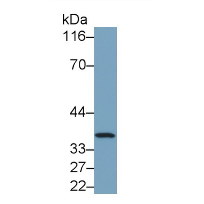 Lactate Dehydrogenase B (LDHB) Human Monoclonal Antibody