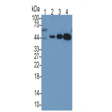 TATA Binding Protein (TBP) Human Monoclonal Antibody