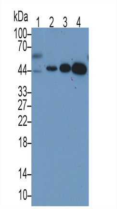 TATA Binding Protein (TBP) Human Monoclonal Antibody