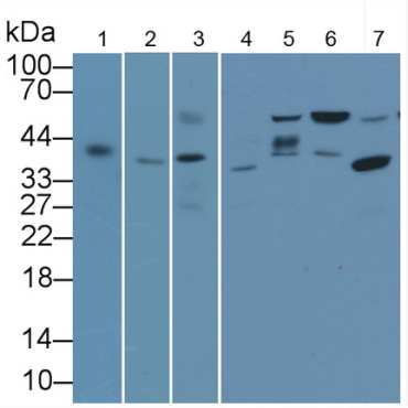 TATA Binding Protein (TBP) Human Monoclonal Antibody