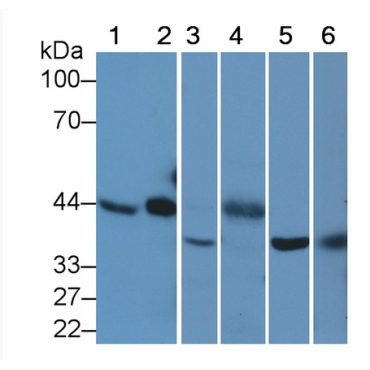 TATA Binding Protein (TBP) Human Monoclonal Antibody