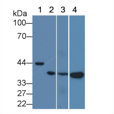 TATA Binding Protein (TBP) Human Monoclonal Antibody