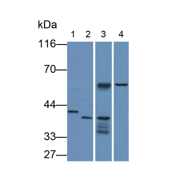 TATA Binding Protein (TBP) Human Monoclonal Antibody