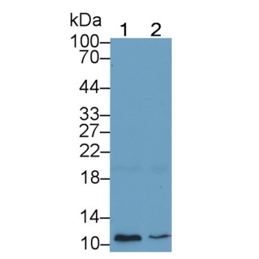 Glycophorin A (GYPA) Human Monoclonal Antibody