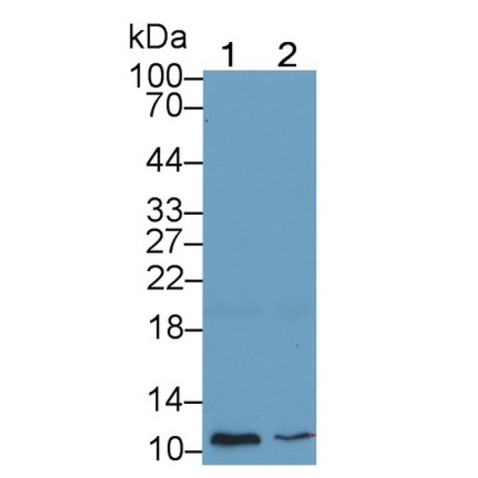 Glycophorin A (GYPA) Human Monoclonal Antibody