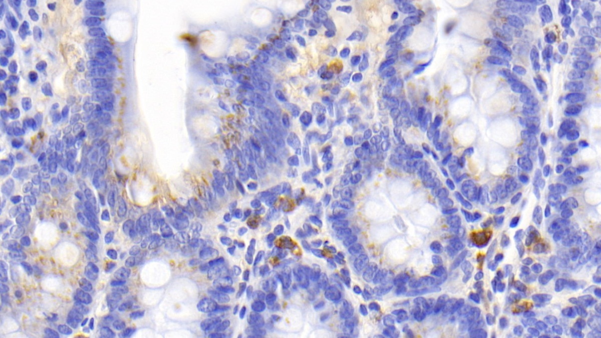 Cluster Of Differentiation (CD163) Rat Monoclonal Antibody