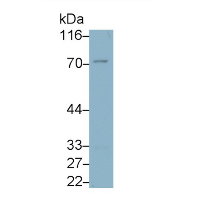 Immunoglobulin Superfamily, Member 12 (IGSF12) Mouse Monoclonal Antibody