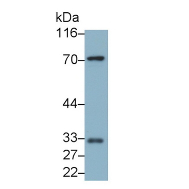 Immunoglobulin Superfamily, Member 12 (IGSF12) Mouse Monoclonal Antibody