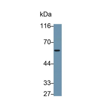 Immunoglobulin Superfamily, Member 12 (IGSF12) Mouse Monoclonal Antibody