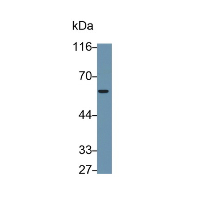 Immunoglobulin Superfamily, Member 12 (IGSF12) Mouse Monoclonal Antibody