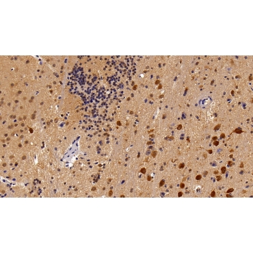 Signal Transducer And Activator Of Transcription 3 (STAT3) Human, Mouse, Rat Monoclonal Antibody