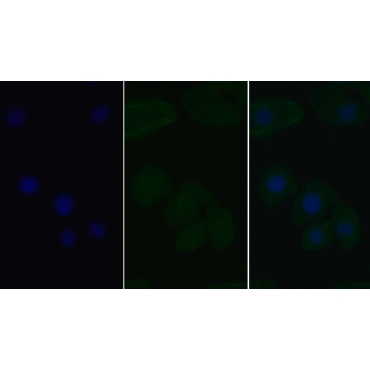 Signal Transducer And Activator Of Transcription 3 (STAT3) Human Monoclonal Antibody