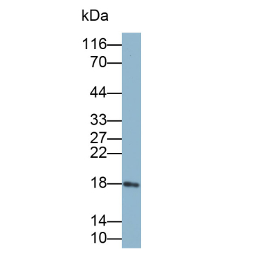 Ribonuclease A3 (RNASE3) Human Monoclonal Antibody