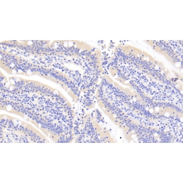 Ribonuclease A3 (RNASE3) Human Monoclonal Antibody