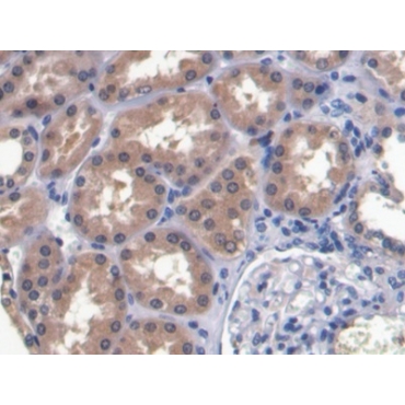 Ribonuclease A3 (RNASE3) Human Monoclonal Antibody