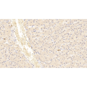 Inhibin Beta B (INHbB) Human Monoclonal Antibody