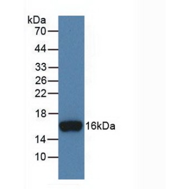 Inhibin Beta B (INHbB) Human Monoclonal Antibody