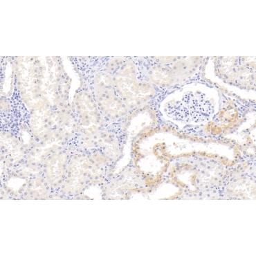 Inhibin Beta B (INHbB) Human Monoclonal Antibody