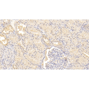 Inhibin Beta B (INHbB) Human Monoclonal Antibody