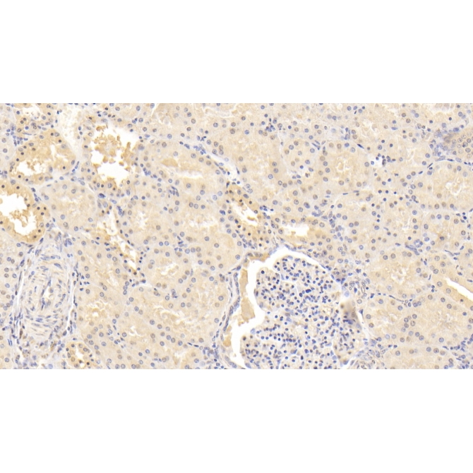 Inhibin Beta B (INHbB) Human Monoclonal Antibody