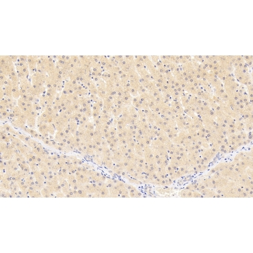 Inhibin Beta B (INHbB) Human Monoclonal Antibody