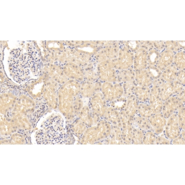 Inhibin Beta B (INHbB) Human Monoclonal Antibody