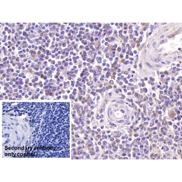 Killer Cell Lectin Like Receptor Subfamily K, Member 1 (KLRK1) Human Monoclonal Antibody
