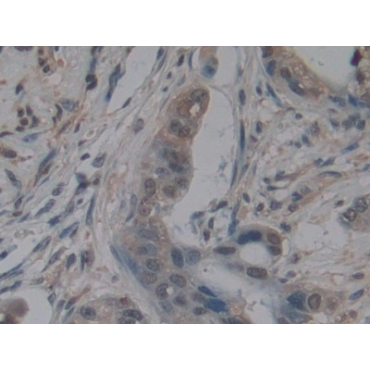 S100 Calcium Binding Protein A6 (S100A6) Human Monoclonal Antibody