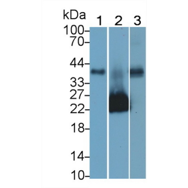 Junctional Adhesion Molecule 1 (JAM1) Human Monoclonal Antibody