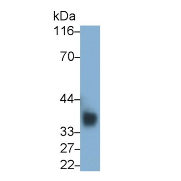 Cluster Of Differentiation 7 (CD7) Human Monoclonal Antibody
