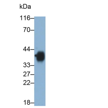 Cluster Of Differentiation 7 (CD7) Human Monoclonal Antibody