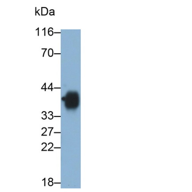 Cluster Of Differentiation 7 (CD7) Human Monoclonal Antibody