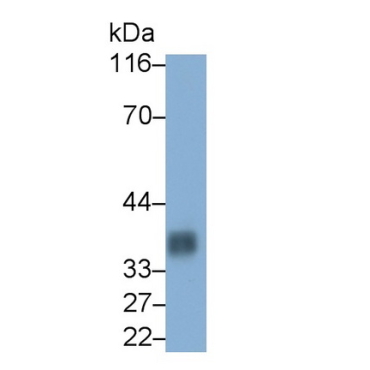 Cluster Of Differentiation 7 (CD7) Human Monoclonal Antibody