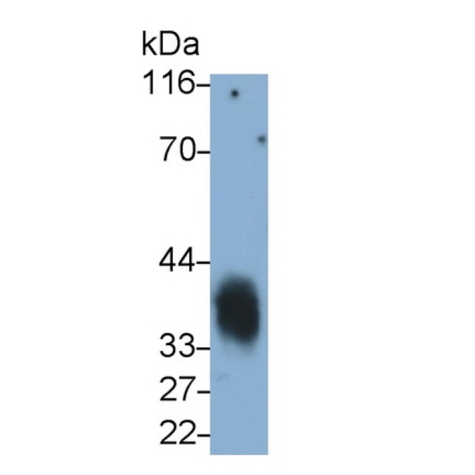 Cluster Of Differentiation 7 (CD7) Human Monoclonal Antibody
