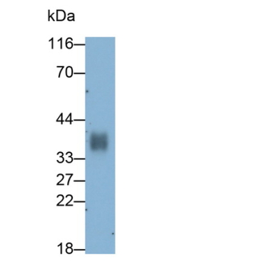Cluster Of Differentiation 7 (CD7) Human Monoclonal Antibody