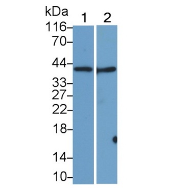 Sialic Acid Binding Ig Like Lectin 7 (SIGLEC7) Human Monoclonal Antibody