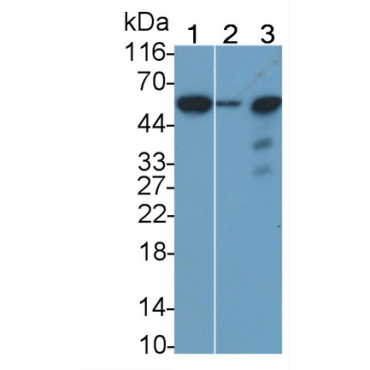 Sialic Acid Binding Ig Like Lectin 7 (SIGLEC7) Human Monoclonal Antibody
