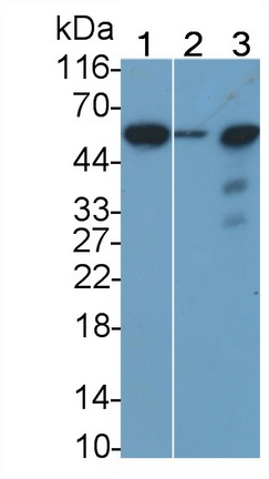Sialic Acid Binding Ig Like Lectin 7 (SIGLEC7) Human Monoclonal Antibody